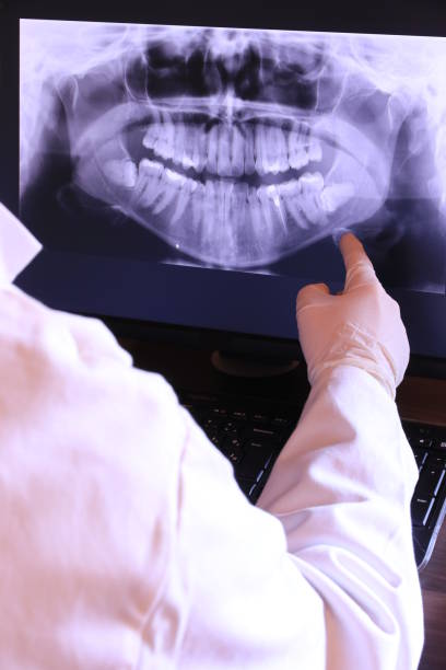 Best Emergency Root Canal Treatment in West Livingston, TX