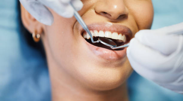 Best Emergency Dental Care for Abscessed Tooth in West Livingston, TX