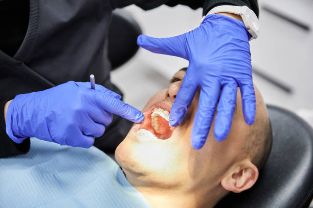 Best Emergency Dental Services for Seniors in West Livingston, TX
