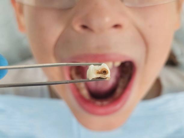 Best Orthodontic Emergency Dentist in West Livingston, TX
